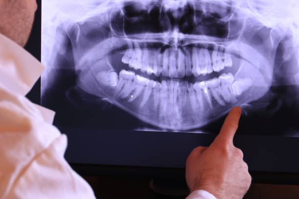 Best Emergency Root Canal Treatment in Lake Arrowhead, ME