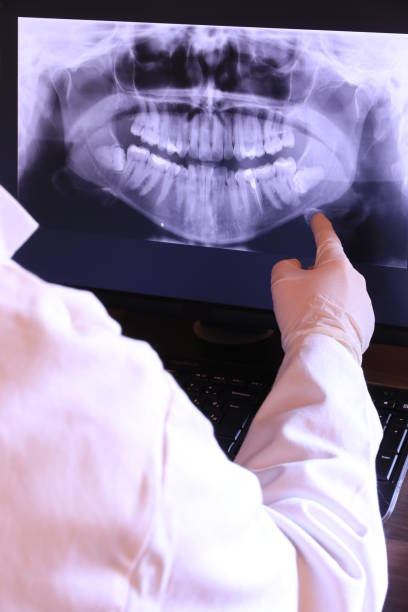 Best Emergency Tooth Extraction in Lake Arrowhead, ME