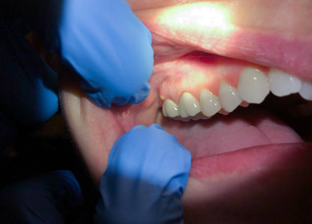 Best Emergency Treatment for Toothache in Lake Arrowhead, ME