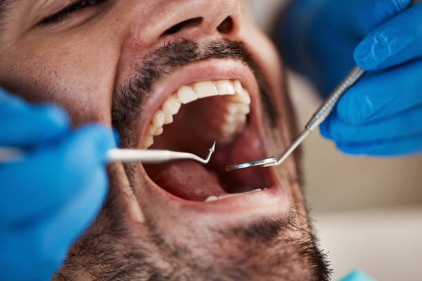 Best Emergency Broken Tooth Repair in Lake Arrowhead, ME